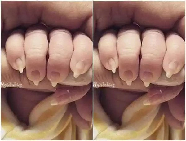 Checkout Viral Photo Of Baby Born With Long Nails